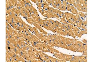 ABIN7093234 and ABIN7097246 at 1/100 staining Rat heart tissue by IHC-P. (SOD2 antibody  (acLys68))