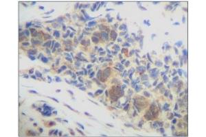 Image no. 3 for anti-Chemokine (C-X-C Motif) Ligand 14 (CXCL14) antibody (ABIN181664) (CXCL14 antibody)