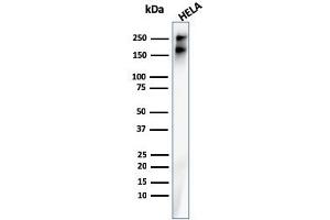 Western Blot Analysis of Human HeLa cell lysate using SPTBN2 Recombinant Mouse Monoclonal Antibody (rSPTBN2/1778).