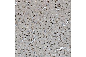 IHC analysis of YWHAE using anti YWHAE antibody (ABIN7599166). (YWHAE antibody  (AA 1-255))
