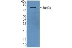 Detection of Recombinant PCNA using Polyclonal Antibody to Proliferating Cell Nuclear Antigen (PCNA) (PCNA antibody  (AA 6-261))