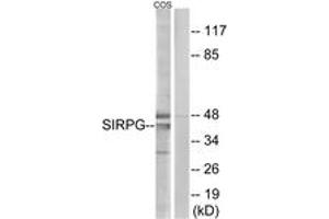 Western blot analysis of extracts from COS cells, using SIRPG Antibody. (SIRPG antibody  (AA 101-150))