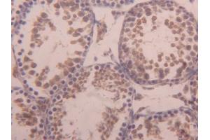 DAB staining on IHC-P; Samples: Mouse Testis Tissue