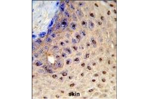 Formalin-fixed and raffin-embedded human skin reacted with X3 Antibody (N-term), which was peroxidase-conjugated to the secondary antibody, followed by DAB staining. (Paired Box 3 antibody  (N-Term))