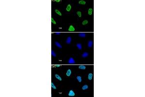 Histone H3 acetyl Lys27 mAb tested by immunofluorescence. (Histone 3 antibody  (H3K27ac))