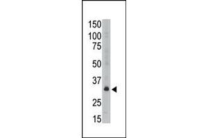 Image no. 1 for anti-Melanoma Antigen Family A, 6 (MAGEA6) (C-Term) antibody (ABIN358649) (MAGEA6 antibody  (C-Term))