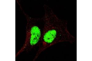 Fluorescent confocal image of SY5Y cells stained with phospho-Sox2-  antibody.
