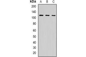 Western blot analysis of p115 expression in BT474 (A), K562 (B), A549 (C) whole cell lysates. (ARHGAP4 antibody)
