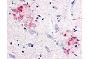 Immunohistochemistry of APP in human brain (Alzheimer’s disease) tissue with APP antibody at 10 μg/ml. (APP antibody)