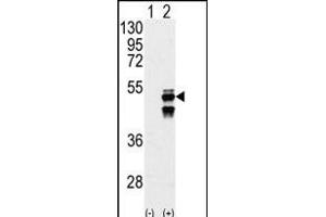 Western blot analysis of M1F (arrow) using M1F Antibody (N-term) (ABIN392883 and ABIN2842287). (PPM1F antibody  (N-Term))