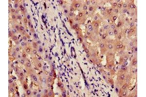 Immunohistochemistry of paraffin-embedded human liver tissue using ABIN7156716 at dilution of 1:100 (ILF2 antibody  (AA 1-390))