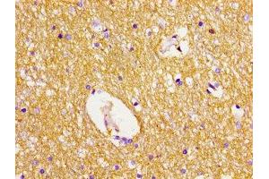 Immunohistochemistry of paraffin-embedded human brain tissue using ABIN7150072 at dilution of 1:100