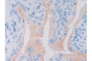 Immunohistochemistry (IHC) image for anti-Interleukin 6 Signal Transducer (Gp130, Oncostatin M Receptor) (IL6ST) (AA 238-500) antibody (ABIN7430555)