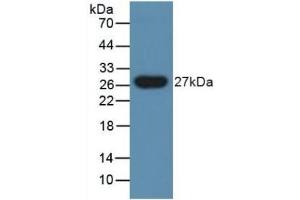 Detection of PGLYRP1 in Human Urine using Polyclonal Antibody to Peptidoglycan Recognition Protein 1 (PGLYRP1) (PGLYRP1 antibody  (AA 18-183))