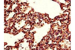 Immunohistochemistry of paraffin-embedded human lung tissue using ABIN7173415 at dilution of 1:100 (TPI1 antibody  (AA 169-228))