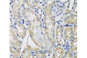 Immunohistochemistry of paraffin-embedded Mouse kidney using MRPS22 Polyclonal Antibody at dilution of 1:100 (40x lens). (MRPS22 antibody)