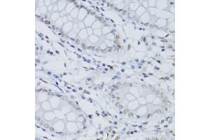 Immunohistochemistry of paraffin-embedded human colon using SNRNP70 antibody (ABIN5973598) at dilution of 1/100 (40x lens). (SNRNP70 antibody)