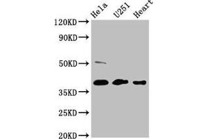 Western Blot Positive WB detected in: Hela whole cell lysate, U251 whole cell lysate, Mouse heart tissue All lanes: RCN3 antibody at 4. (RCN3 antibody  (AA 71-161))