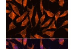 Immunofluorescence analysis of L929 cells using LHPP Polyclonal Antibody at dilution of 1:100.