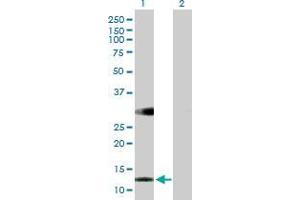 Lane 1: RBP5 transfected lysate ( 15. (RBP5 293T Cell Transient Overexpression Lysate(Denatured))