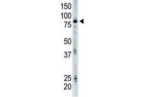 Image no. 1 for anti-SMAD Specific E3 Ubiquitin Protein Ligase 2 (SMURF2) (N-Term) antibody (ABIN357471) (SMURF2 antibody  (N-Term))