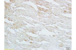 Immunohistochemistry (Paraffin-embedded Sections) (IHC (p)) image for anti-Heparin-Binding EGF-Like Growth Factor (HBEGF) (AA 51-150) antibody (ABIN701050)