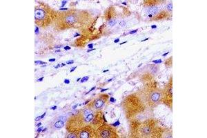 Immunohistochemical analysis of UBE2J2 staining in rat liver  formalin fixed paraffin embedded tissue section. (UBE2J2 antibody)