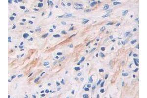 Immunohistochemistry (IHC) image for anti-Phosphoinositide-3-Kinase, Catalytic, beta Polypeptide (PIK3CB) (AA 321-507) antibody (ABIN7438307)