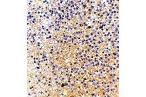 Immunohistochemistry (IHC) image for anti-Lymphocyte Antigen 86 (LY86) (Middle Region) antibody (ABIN1030998) (LY86 antibody  (Middle Region))