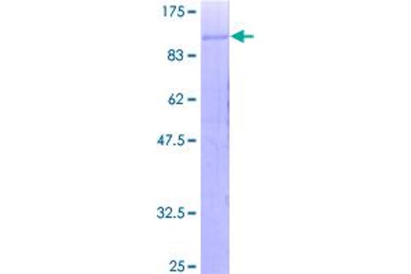 C1R Protein (AA 1-705) (GST tag)