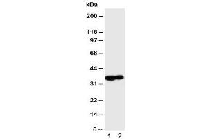 Western blot testing of Kallikrein 9 antibody and Lane 1:  MCF-7 (Kallikrein 9 antibody  (C-Term))