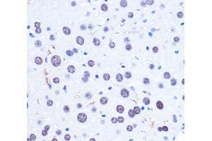 Immunohistochemistry of paraffin-embedded Mouse liver using CHD4 Polyclonal Antibody at dilution of 1:100 (40x lens). (CHD4 antibody)