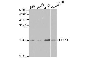 Western blot analysis of extracts of various cell lines, using GHRH antibody. (GHRH antibody  (AA 21-107))
