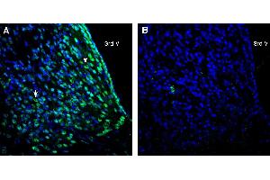 Expression of CD81 in rat medial habenula. (CD81 antibody  (Extracellular))
