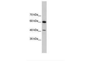 Image no. 3 for anti-DAZ Associated Protein 1 (DAZAP1) (AA 321-370) antibody (ABIN202449) (DAZAP1 antibody  (AA 321-370))
