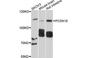 Western blot analysis of extracts of various cell lines, using PCDH10 antibody (ABIN4904694) at 1:1000 dilution. (PCDH10 antibody)