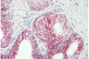 Human Prostate: Formalin-Fixed, Paraffin-Embedded (FFPE) (Follistatin antibody  (AA 312-340))
