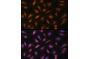 Immunofluorescence analysis of U-2 OS cells using FGF2 Rabbit pAb (ABIN3020744, ABIN3020745, ABIN3020746 and ABIN6213702) at dilution of 1:100 (40x lens). (FGF2 antibody  (AA 143-288))