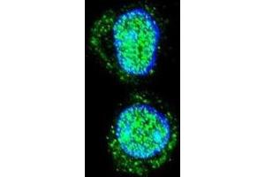 Immunofluorescence (IF) image for anti-Homeobox A10 (HOXA10) antibody (ABIN2995594)