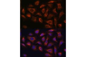 Immunofluorescence analysis of U-2 OS cells using  antibody (ABIN7265486) at dilution of 1:100.