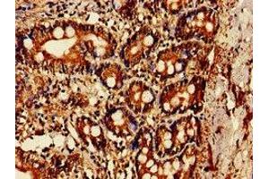 Immunohistochemistry of paraffin-embedded human small intestine tissue using ABIN7142170 at dilution of 1:100 (OAS1 antibody  (AA 296-395))