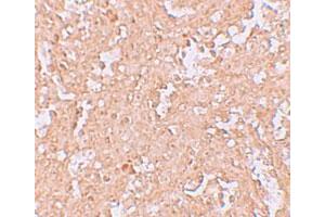 Immunohistochemical staining of human spleen cells with ZBTB8 polyclonal antibody  at 2.