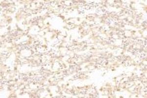Immunohistochemistry analysis of paraffin-embedded rat placenta using,Slc6a6 (ABIN7075842) at dilution of 1: 1000
