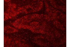 IF analysis of RNGTT using anti-RNGTT antibody (ABIN7599723). (RNGTT antibody  (AA 11-438))