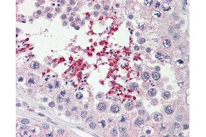 Abcd2 antibody  (AA 338-558)
