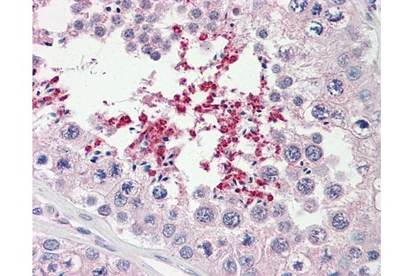 Abcd2 antibody  (AA 338-558)