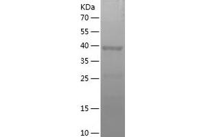 Western Blotting (WB) image for Methionine Adenosyltransferase I, alpha (MAT1A) (AA 215-395) protein (His-IF2DI Tag) (ABIN7283534) (MAT1A Protein (AA 215-395) (His-IF2DI Tag))