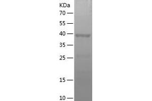 Western Blotting (WB) image for Methionine Adenosyltransferase I, alpha (MAT1A) (AA 215-395) protein (His-IF2DI Tag) (ABIN7123931) (MAT1A Protein (AA 215-395) (His-IF2DI Tag))