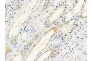 anti-ADAM Metallopeptidase with Thrombospondin Type 1 Motif, 7 (ADAMTS7) (C-Term) antibody