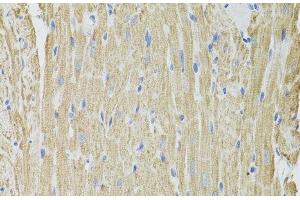 Immunohistochemistry of paraffin-embedded Rat heart using FHIT Polyclonal Antibody at dilution of 1:100 (40x lens). (FHIT antibody)